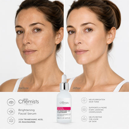 skinChemists Brightening Facial Serum with Tranexamic Acid 2.5% and Niacinamide 4% 30ml