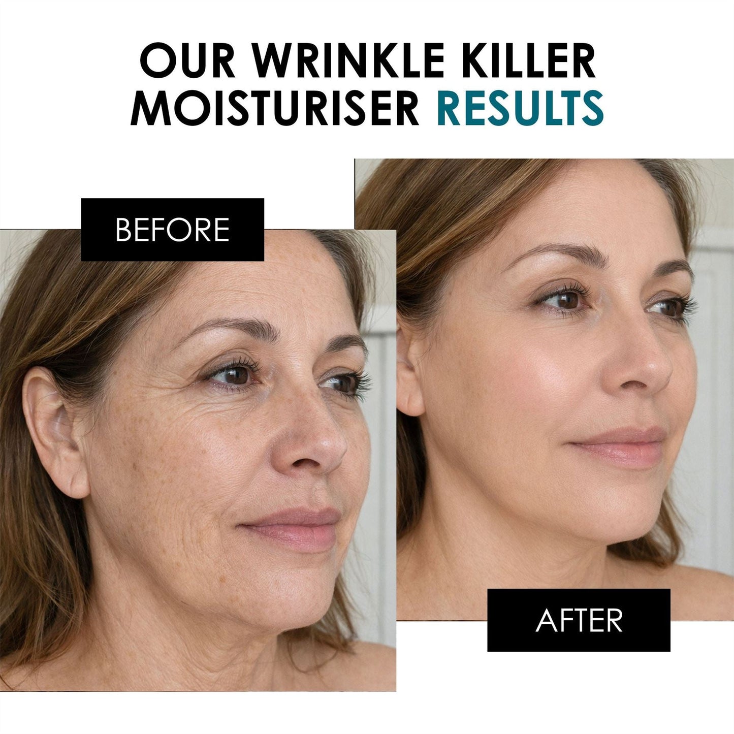 SC Wrinkle Killer SFP50 Duo Moisturiser 50ml - skinChemists