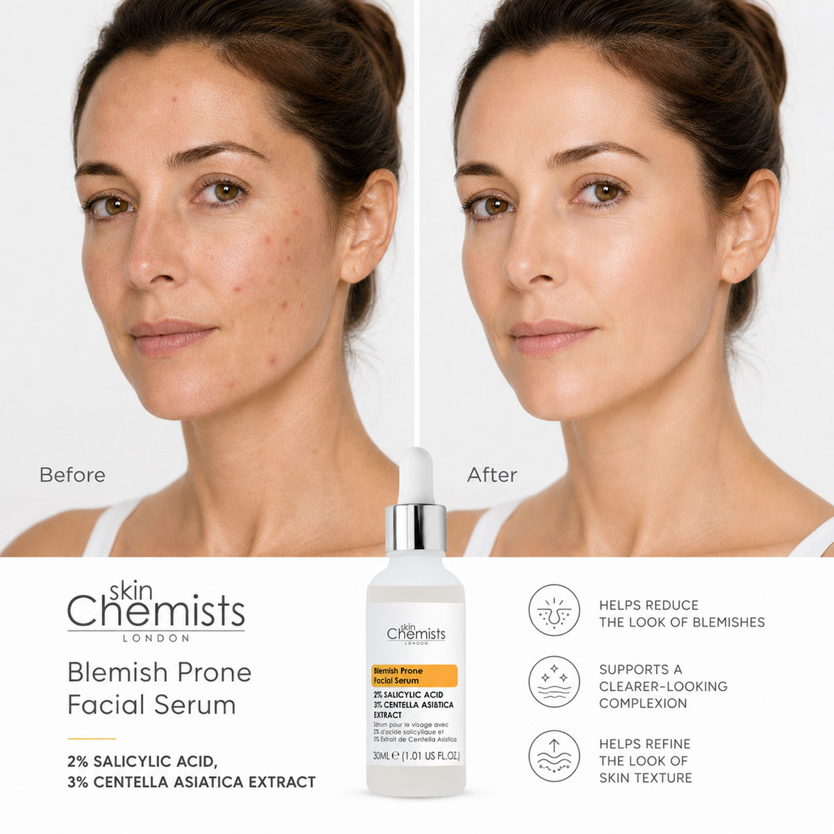 SkinChemists Blemish Prone Facial Serum 30ml — 2% Salicylic Acid, 3% Centella Asiatica Extract