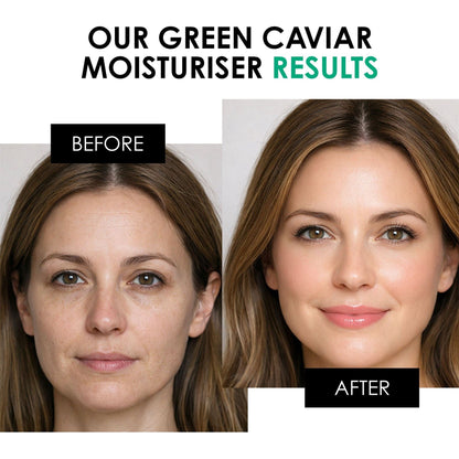 Green Caviar Day Moisturiser 30ml - skinChemists