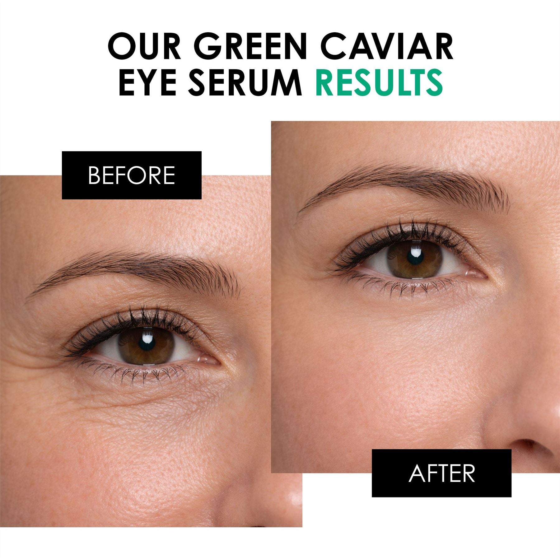 Green Caviar Eye Serum 15ml - skinChemists