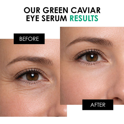 Green Caviar Eye Serum 15ml - skinChemists